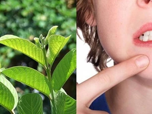 Trị mụn trứng cá trong mùa hè với lá ổi