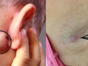 4 bộ phận trên cơ thể 'nhô' ra bất thường cảnh báo bệnh nguy hiểm, chớ dại chủ quan