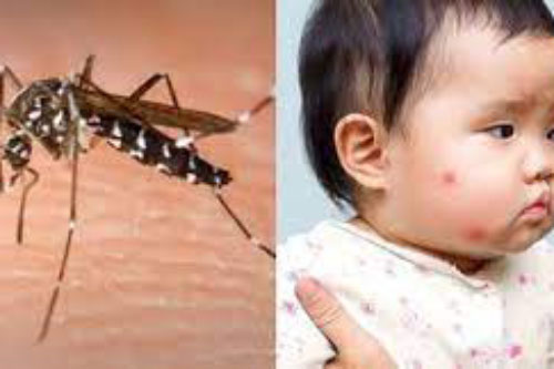 5 cách đuổi muỗi hiệu quả, an toàn, không hóa chất cho nhà có trẻ nhỏ