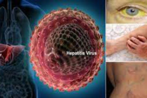 Dấu hiệu "2 ngứa 1 đen" trên cơ thể cảnh báo căn bệnh nguy hiểm, hãy đi khám ngay