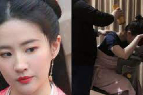 Đang quay phim cùng Trần Hiểu mà Lưu Diệc Phi lộ ảnh chấn thương đến mức phải châm cứu cột sống cổ