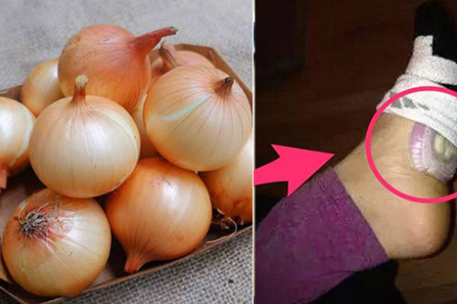 Điều gì sẽ xảy ra với cơ thể nếu để một lát hành tây vào chân khi ngủ?