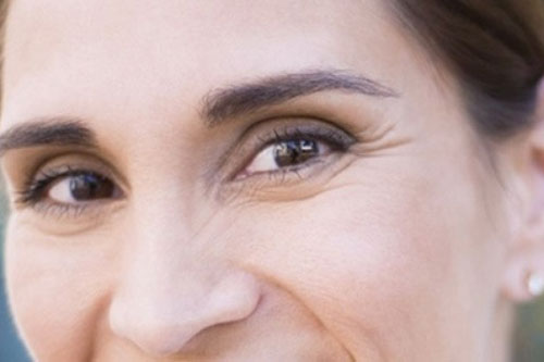 Mặt nạ giúp xóa vết chân chim vô cùng hiệu quả