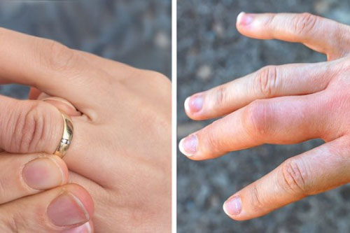 Tại sao nên cởi đồ trang sức trước khi đi ngủ?