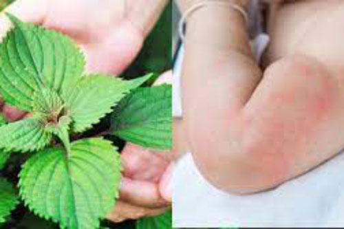 6 loại lá tắm trị rôm sảy, mẩn ngứa cực kỳ hiệu quả, mẹ cần biết ngay