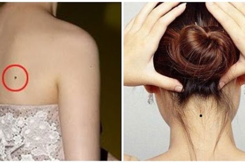 3 nốt ruồi kém duyên, cản trở tài lộc, 4 nốt ruồi phú quý, xấu đến mấy cũng đừng xóa đi