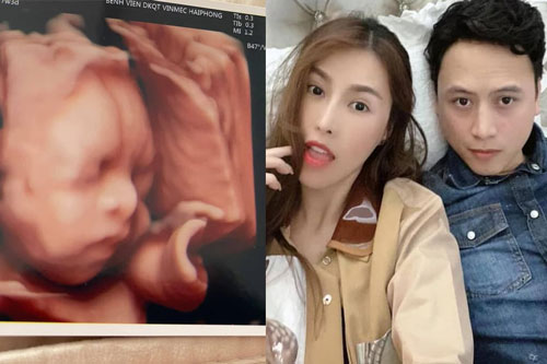 Sau lùm xùm, Quế Vân khoe ảnh siêu âm con ở tháng thứ 7, có động thái đáng chú ý khi bé được khen giống bố