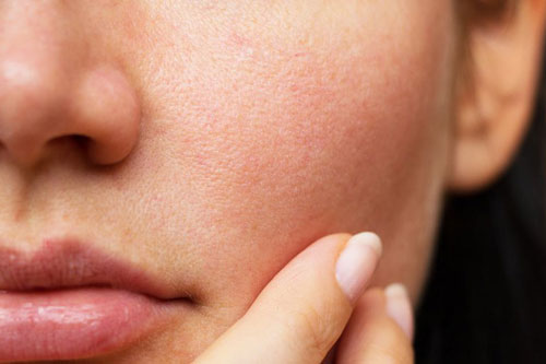 Cách thu nhỏ lỗ chân lông tại nhà