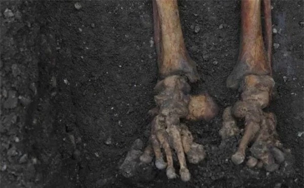 Bí ẩn 314 bộ xương vỡ vụn của người Anh thời Trung cổ