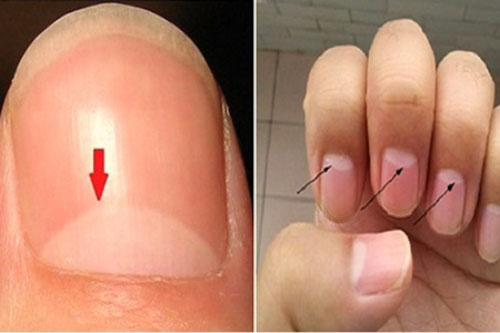 Cơ thể xuất hiện 2 đỏ 1 mùi gan của ban đang suy kiệt, càng để lâu càng rút ngắn tuổi thọ