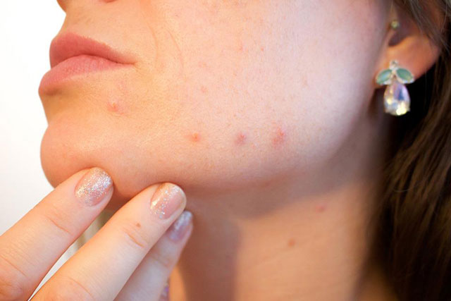 5 dấu hiệu cảnh báo bạn cần thay đổi chế độ ăn uống