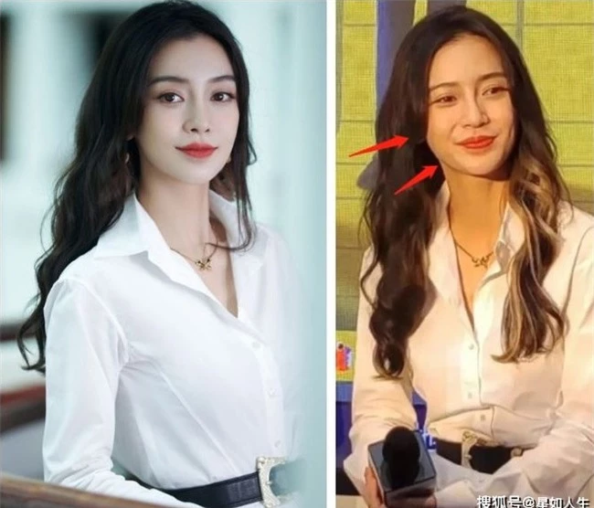 Gương mặt của Angelababy ngày càng khác lạ khiến netizen không thể nhận ra.