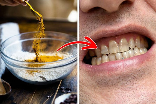 6 thói quen hàng ngày làm răng ố vàng, xỉn màu