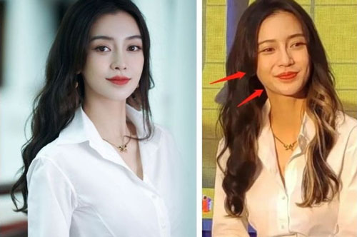 Gương mặt Angelababy ngày càng khác lạ, di chứng của phẫu thuật thẩm mỹ cũng lộ rõ?