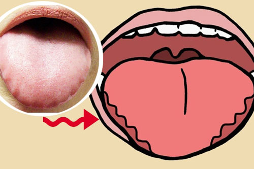 Dấu hiệu cảnh bảo sức khỏe bạn phải đi khám ngay