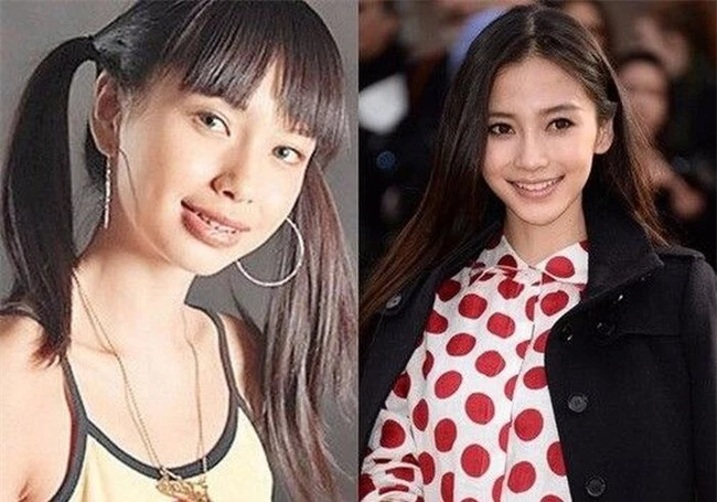 Nhưng Angelababy lại vướng nghi vấn phẫu thuật thẩm mỹ.