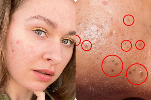 3 điều khiến bạn già hơn hẳn so với tuổi, mà chỉ xuất phát từ một nguyên nhân duy nhất