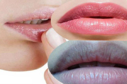 3 cách khắc phục tình trạng môi thâm tại nhà