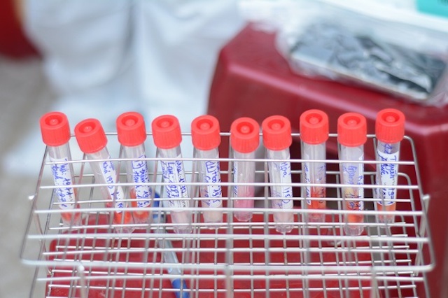 Quảng Ngãi : Công  bố  ca dương tính cộng đồng Covid - 19 ở  xã Tịnh Kỳ