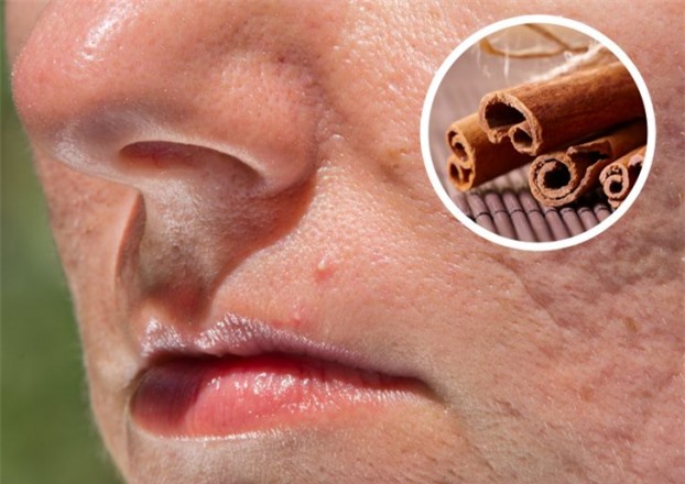 Điều gì sẽ xảy ra khi bạn ăn quế thường xuyên?