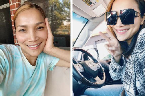 Cận cảnh gương mặt Hồng Ngọc sau 1 năm bị bỏng nặng