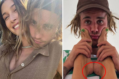Thể hiện sự cuồng vợ nhưng Justin Bieber lại không may để lộ khuyết điểm đáng xấu hổ của Hailey
