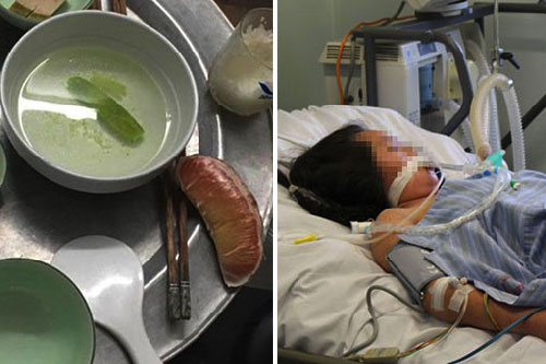 3 việc tuyệt đối không làm sau khi ăn no kẻo ung thư 'gọi cửa'