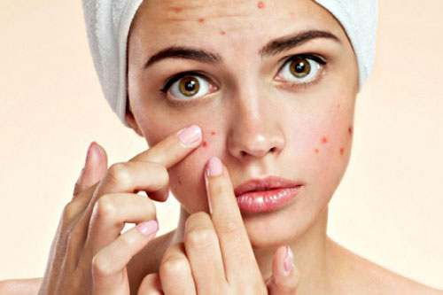 Cách trị mụn cấp tốc và hiệu quả nhất chỉ trong một ngày