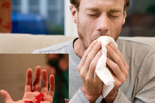 10 dấu hiệu ung thư thường thấy nhất mà mọi người hay bỏ qua