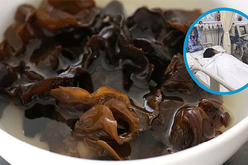 3 đại kỵ khi ăn mộc nhĩ ai cũng phải biết kẻo rước bệnh vào thân