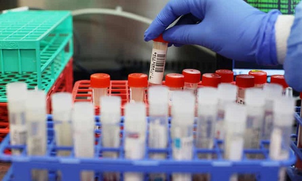 Các ca mắc Covid-19 liên quan BV Bệnh Nhiệt đới TW cơ sở 2 nhiễm biến chủng của Ấn Độ