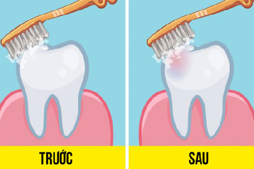 Đã có câu trả lời cho tranh cãi nên đánh răng trước hay sau khi ăn sáng