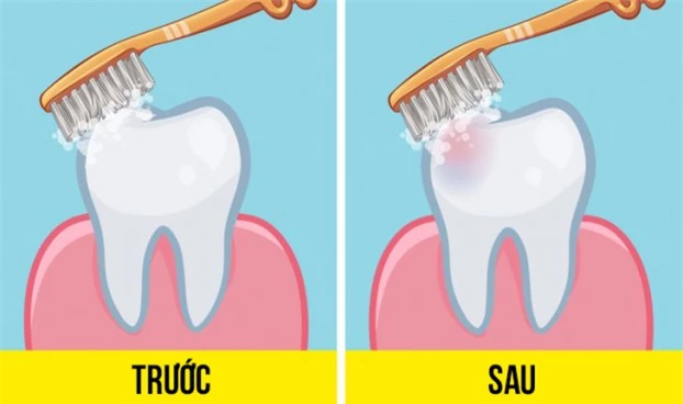 Đã có câu trả lời cho tranh cãi nên đánh răng trước hay sau khi ăn sáng 2