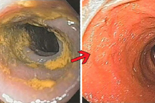 4 thực phẩm giúp đường ruột sạch bong, cặn bẩn cứng đầu đến mấy cũng bị đánh bật