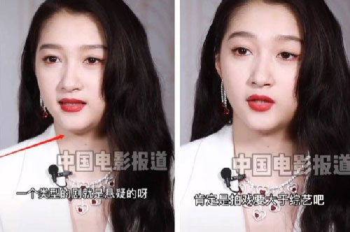 Quan Hiểu Đồng bị soi nhan sắc xuống cấp trong hình chưa chỉnh sửa, gương mặt sưng cùng cằm ngấn mỡ