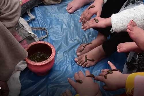 Clip: Truyền thống trị liệu bằng đỉa hàng nghìn năm ở Kashmir