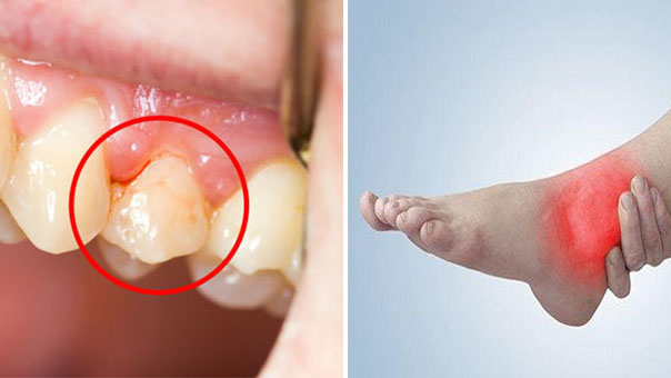 4 triệu chứng khi ngủ dậy chứng tỏ gan không tốt, cẩn thận ung thư sớm