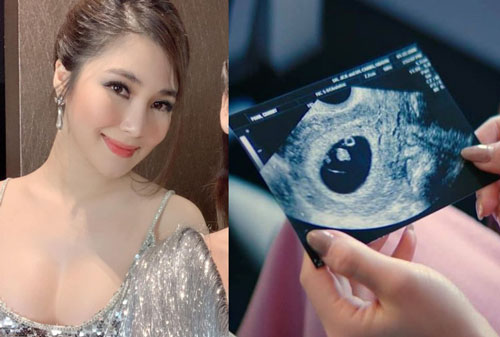 Hương Tràm bất ngờ đăng ảnh chụp siêu âm thai nhi, ngầm thông báo mang thai sau 2 năm sang Mỹ du học?