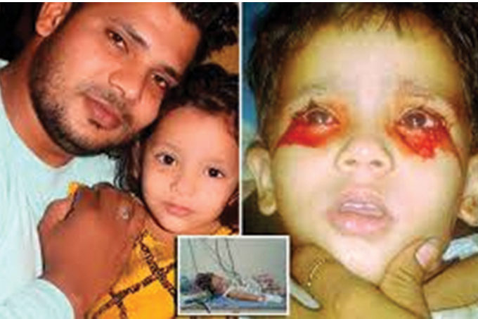 “Mồ hôi máu”, căn bệnh lạ thách thức y học hiện đại