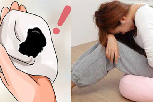 3 điểm bất thường trong kỳ kinh nguyệt cảnh báo buồng trứng bị bệnh, có thể gây vô sinh