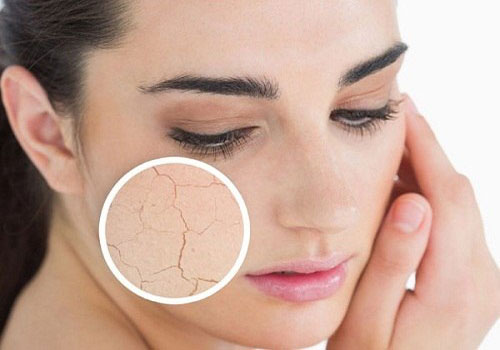 Dấu hiệu cảnh báo da lão hóa sớm bạn phải biết