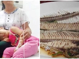 Con bị hóc xương cá đau đớn, mẹ nhanh trí làm ngay 3 việc: Bác sĩ tấm tắc khen