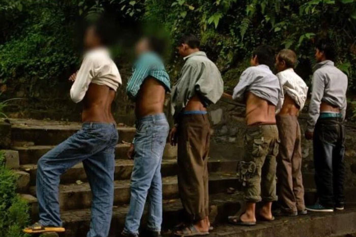 Ngôi làng ở Nepal - Nơi mỗi người chỉ có một quả thận