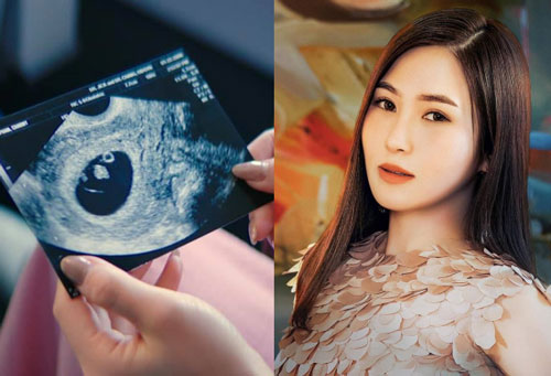 Động thái tiếp theo của Hương Tràm sau khi đăng ảnh làm MXH 'náo loạn' vì nghi vấn mang thai: Tung poster MV!