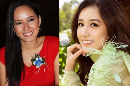 Hoa hậu Mai Phương Thúy tiết lộ sự cố khiến hàm răng thay đổi