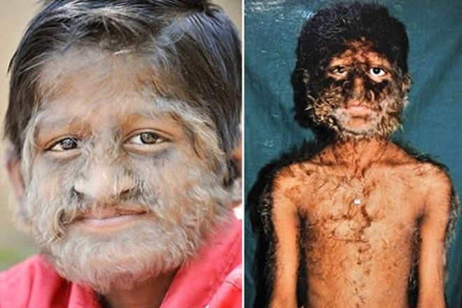 Những căn bệnh kỳ lạ nhất thế giới