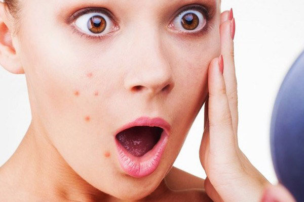 Mụn chi chít trên da chỉ vì những sai lầm cực nghiêm trọng