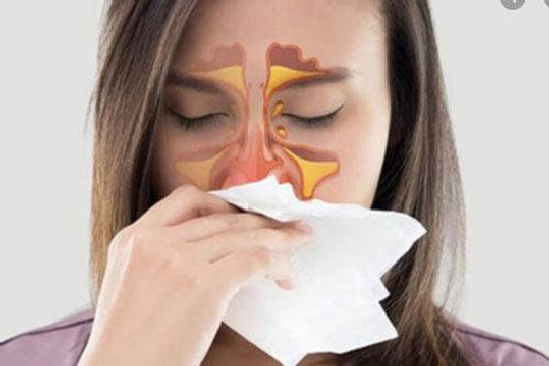 Bị viêm xoang cần kiêng thực phẩm nào?