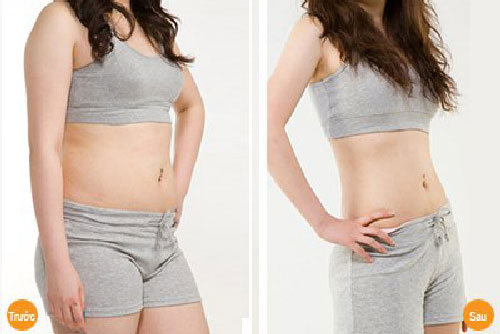 Tan hết mỡ bụng trong 1 tuần nếu chườm đá lạnh theo cách này
