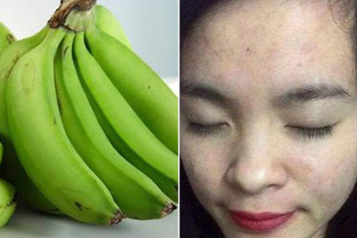Công thức làm trắng da, sạch mụn tiết kiệm với chuối xanh